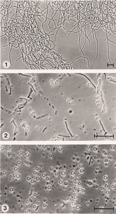acremproto.jpg (89423 bytes)