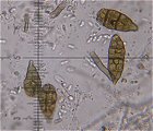 Alternaria aternata spores MykoGolfer