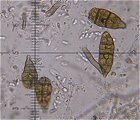 Alternaria aternata spores  MykoGolfer