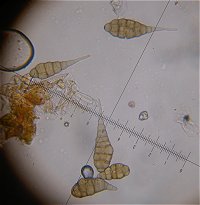 Alternaria spores  MykoGolfer