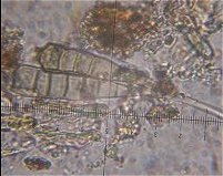 Alternaria spores MykoGolfer