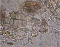 Alternaria spores  MykoGolfer