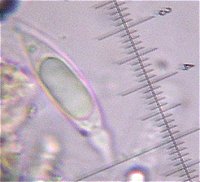 Anthostomella spore  MykoGolfer