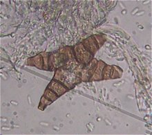 Asterosporium asterospermum  MykoGolfer