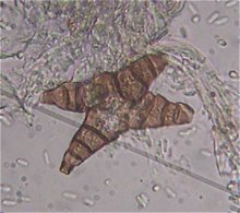 Asterosporium asterospermum MykoGolfer