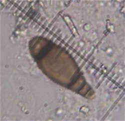 Bactrodesmium obovatum  MykoGolfer