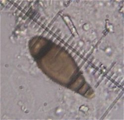 Bactrodesmium obovatum MykoGolfer
