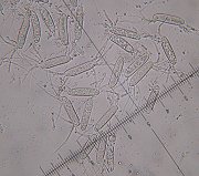 Chaetospermum chaetosporum spores MykoGolfer