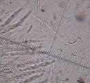 Chaetosphaeria pulviscula MykoGolfer