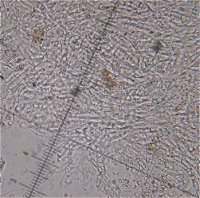 Clitocybe phyllophila hyphae MykoGolfer