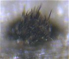 Colletotrichum dematium MykoGolfer