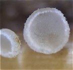 Cyathicula cyathoidea MykoGolfer