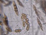 Didymosphaeria conoidea spores MykoGolfer