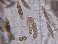 Didymosphaeria conoidea spores  MykoGolfer