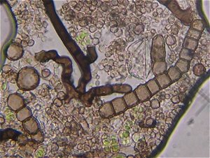 Diplococcium spicatum spores MykoGolfer