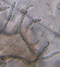 Episphaeria fraxinicola encrusted hairs MykoGolfer