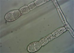 Erysiphe spores  MykoGolfer
