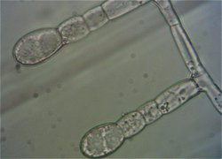 Erysiphe spores MykoGolfer