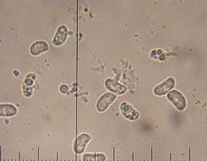 Exidiopsis effusa spores MykoGolfer