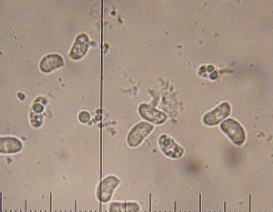 Exidiopsis effusa spores  MykoGolfer