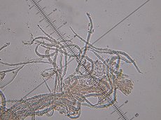 Flagelloscypha minutissima MykoGolfer