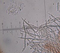 Flagelloscypha minutissima  MykoGolfer
