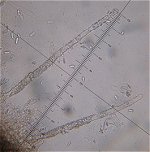 Hyphoderma setigerum MykoGolfer