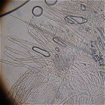 Lachnella villosa - hairs  MykoGolfer