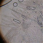 Lachnella villosa - hairs MykoGolfer