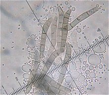 Lasiosphaeris hirsuta spores  MykoGolfer