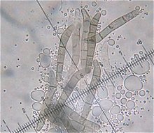 Lasiosphaeris hirsuta spores MykoGolfer