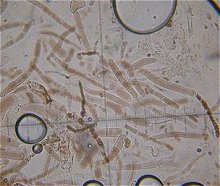 Leccinum fuscoalbum cap cells  MykoGolfer