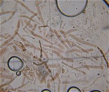 Leccinum fuscoalbum cap cells MykoGolfer