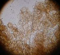 Lepiota aspera hyphal ends MykoGolfer