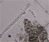 Lophiostoma vagabundum  MykoGolfer