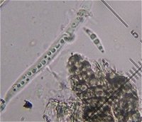 Lophiostoma vagabundum MykoGolfer