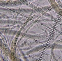 Ophiobolus erythrosporus MykoGolfer