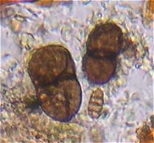 Otthia spiraeae MykoGolfer