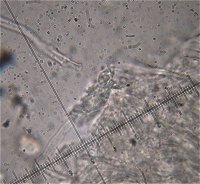 Oxyporus corticola cystidia  MykoGolfer