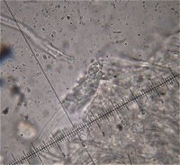 Oxyporus corticola cystidia MykoGolfer