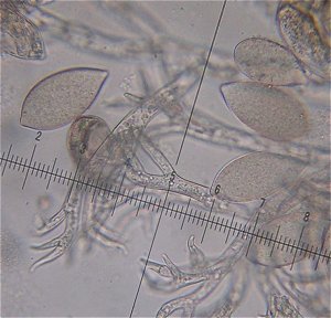 Peronospora spores  MykoGolfer