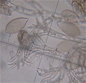 Peronospora spores MykoGolfer