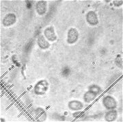 Spores of Phlebiella tullasnelloidea MykoGolfer