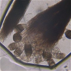 Spores  MykoGolfer