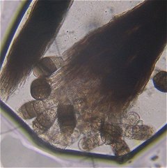 Spores MykoGolfer