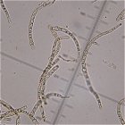 Plagiosphaera immersa MykoGolfer