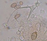 Cystidia MykoGolfer