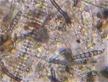 Pseudospiropes obclavatus MykoGolfer
