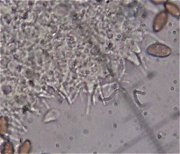 Psilocybe semilanceata cystidia  MykoGolfer