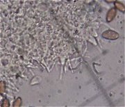 Psilocybe semilanceata cystidia MykoGolfer